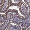 Cytochrome P450 2S1 antibody, NBP2-68881, Novus Biologicals, Immunohistochemistry paraffin image 