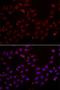 Cystatin SA antibody, LS-C334802, Lifespan Biosciences, Immunofluorescence image 