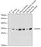 Insulin Like Growth Factor Binding Protein 5 antibody, GTX54362, GeneTex, Western Blot image 