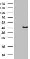 Pleckstrin 2 antibody, TA802769BM, Origene, Western Blot image 