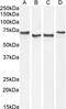 Acetylcholinesterase antibody, GTX89580, GeneTex, Western Blot image 