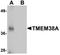 Transmembrane Protein 38A antibody, A15150, Boster Biological Technology, Western Blot image 