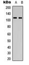 Integrin Subunit Alpha 3 antibody, LS-C368603, Lifespan Biosciences, Western Blot image 