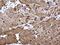 Nicotinamide Phosphoribosyltransferase antibody, GTX128973, GeneTex, Immunohistochemistry paraffin image 