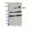 Interferon Induced With Helicase C Domain 1 antibody, M00263, Boster Biological Technology, Western Blot image 