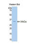 Fascin Actin-Bundling Protein 2, Retinal antibody, LS-C293826, Lifespan Biosciences, Western Blot image 