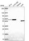 Asparagine synthetase [glutamine-hydrolyzing] antibody, HPA064737, Atlas Antibodies, Western Blot image 