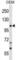 Transient Receptor Potential Cation Channel Subfamily C Member 7 antibody, abx029118, Abbexa, Western Blot image 