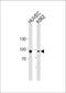 Transglutaminase 2 antibody, PA5-14966, Invitrogen Antibodies, Western Blot image 