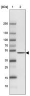 IST1 Factor Associated With ESCRT-III antibody, NBP2-33720, Novus Biologicals, Western Blot image 