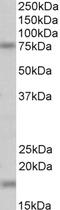 TG(Z) antibody, STJ72422, St John