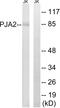 Praja Ring Finger Ubiquitin Ligase 2 antibody, LS-B6589, Lifespan Biosciences, Western Blot image 