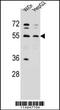 Asparaginyl-TRNA Synthetase antibody, 55-618, ProSci, Western Blot image 