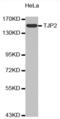 Tight Junction Protein 2 antibody, abx000775, Abbexa, Western Blot image 