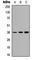 NK2 Homeobox 1 antibody, abx121802, Abbexa, Western Blot image 