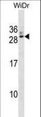 General Transcription Factor IIF Subunit 2 antibody, LS-C157790, Lifespan Biosciences, Western Blot image 