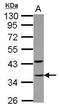General Transcription Factor IIE Subunit 2 antibody, PA5-28177, Invitrogen Antibodies, Western Blot image 