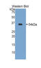 Ornithine Carbamoyltransferase antibody, LS-B13340, Lifespan Biosciences, Western Blot image 