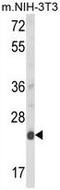 Derlin 1 antibody, GTX81054, GeneTex, Western Blot image 