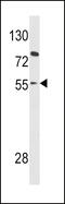 Paired Box 8 antibody, 62-514, ProSci, Western Blot image 