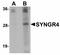Synaptogyrin 4 antibody, LS-C108528, Lifespan Biosciences, Western Blot image 