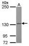 ABL Proto-Oncogene 1, Non-Receptor Tyrosine Kinase antibody, PA5-29287, Invitrogen Antibodies, Western Blot image 