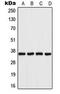 Aldose reductase antibody, GTX54911, GeneTex, Western Blot image 