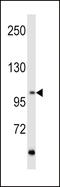 Ret Proto-Oncogene antibody, LS-C99120, Lifespan Biosciences, Western Blot image 