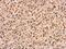 p21 antibody, PA5-34805, Invitrogen Antibodies, Immunohistochemistry paraffin image 