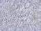 ATM Serine/Threonine Kinase antibody, MA1-23154, Invitrogen Antibodies, Immunohistochemistry paraffin image 