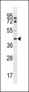 FGF1 Intracellular Binding Protein antibody, 56-935, ProSci, Western Blot image 