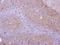 PPP6C antibody, GTX108968, GeneTex, Immunohistochemistry paraffin image 