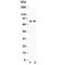 Lysosomal Associated Membrane Protein 1 antibody, R30920, NSJ Bioreagents, Western Blot image 