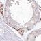 Myotubularin Related Protein 3 antibody, HPA034515, Atlas Antibodies, Immunohistochemistry frozen image 