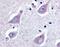 GPER antibody, NLS4271, Novus Biologicals, Immunohistochemistry paraffin image 