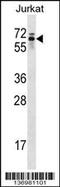 Ro60, Y RNA Binding Protein antibody, 59-050, ProSci, Western Blot image 