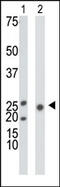 Ketohexokinase antibody, AP13633PU-N, Origene, Western Blot image 