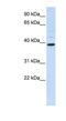 Chitinase Acidic antibody, NBP1-58988, Novus Biologicals, Western Blot image 