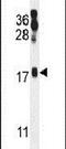 ORMDL Sphingolipid Biosynthesis Regulator 2 antibody, PA5-24302, Invitrogen Antibodies, Western Blot image 