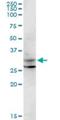 Centromere Protein P antibody, H00401541-M07, Novus Biologicals, Western Blot image 