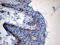 Colony Stimulating Factor 3 antibody, LS-C798845, Lifespan Biosciences, Immunohistochemistry paraffin image 