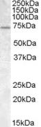 NADH:Ubiquinone Oxidoreductase Core Subunit S3 antibody, orb20233, Biorbyt, Western Blot image 