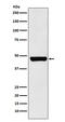 ST13 Hsp70 Interacting Protein antibody, M05692-1, Boster Biological Technology, Western Blot image 
