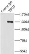 Tubulin Folding Cofactor D antibody, FNab08519, FineTest, Immunoprecipitation image 