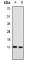 Replication Protein A3 antibody, abx142199, Abbexa, Western Blot image 