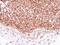 2,4-Dienoyl-CoA Reductase 1 antibody, GTX117130, GeneTex, Immunohistochemistry paraffin image 