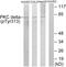 Protein Kinase C Delta antibody, LS-C199450, Lifespan Biosciences, Western Blot image 