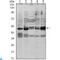 SMAD Family Member 3 antibody, LS-C812771, Lifespan Biosciences, Western Blot image 