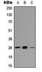 Troponin I3, Cardiac Type antibody, LS-C358888, Lifespan Biosciences, Western Blot image 
