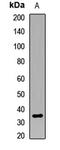 CCR4-NOT Transcription Complex Subunit 8 antibody, LS-C668699, Lifespan Biosciences, Western Blot image 